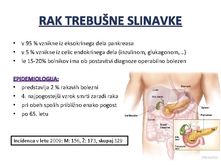 RAK TREBUŠNE SLINAVKE • v 95 % vznikne iz eksokrinega dela pankreasa • v RAK TREBUŠNE SLINAVKE • v 95 % vznikne iz eksokrinega dela pankreasa • v