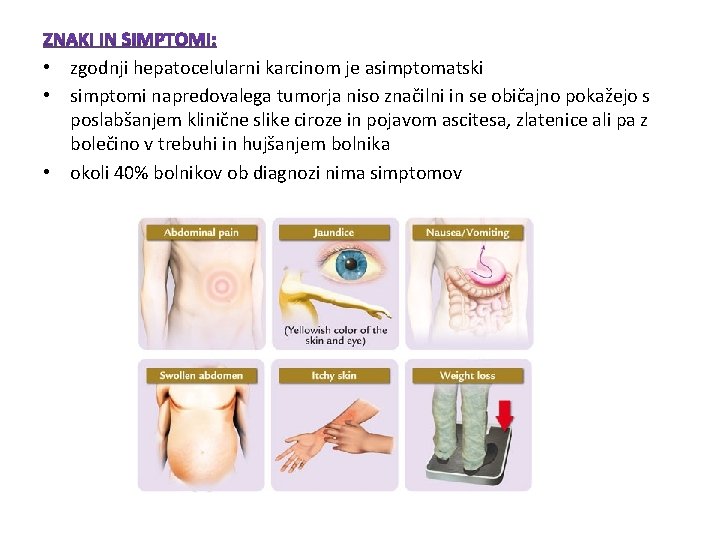 • zgodnji hepatocelularni karcinom je asimptomatski • simptomi napredovalega tumorja niso značilni in • zgodnji hepatocelularni karcinom je asimptomatski • simptomi napredovalega tumorja niso značilni in