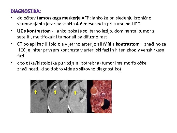 • določitev tumorskega markerja AFP: lahko že pri sledenju kronično spremenjenih jeter na • določitev tumorskega markerja AFP: lahko že pri sledenju kronično spremenjenih jeter na