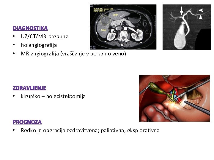• UZ/CT/MRI trebuha • holangiografija • MR angiografija (vraščanje v portalno veno) • • UZ/CT/MRI trebuha • holangiografija • MR angiografija (vraščanje v portalno veno) •