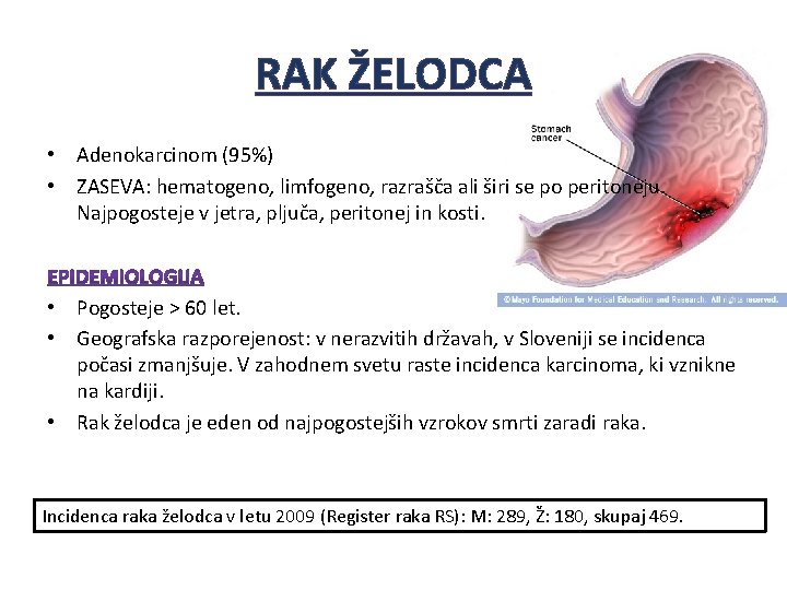 RAK ŽELODCA • Adenokarcinom (95%) • ZASEVA: hematogeno, limfogeno, razrašča ali širi se po RAK ŽELODCA • Adenokarcinom (95%) • ZASEVA: hematogeno, limfogeno, razrašča ali širi se po