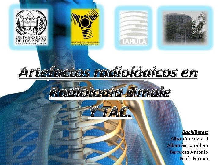 Artefactos radiológicos en Radiología simple Y TAC. Bachilleres: Albarrán Edward Albarrán Jonathan Barrueta Antonio