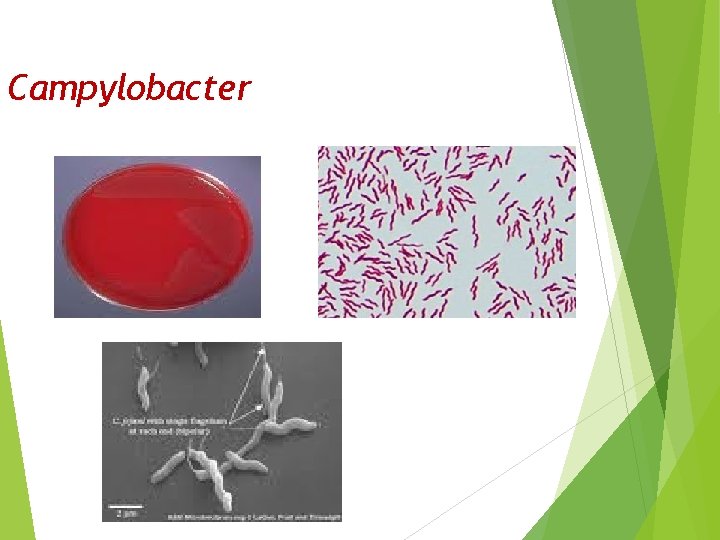 Campylobacter 