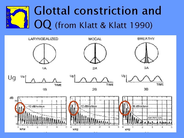 Glottal constriction and OQ (from Klatt & Klatt 1990) Ug 