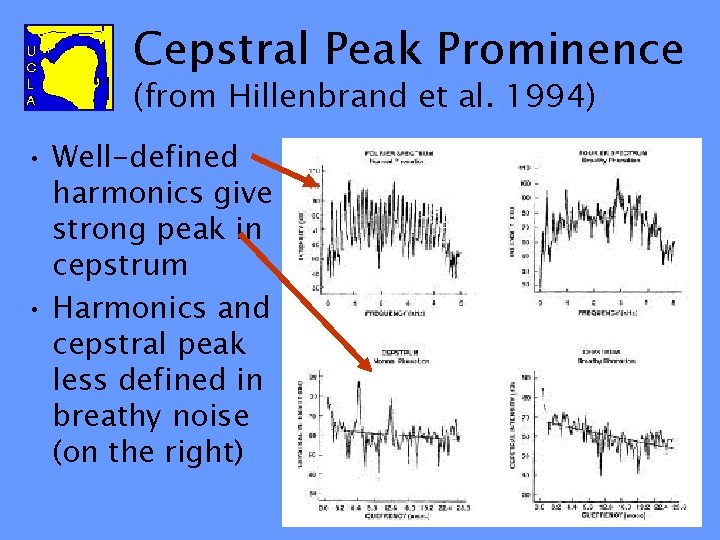 Cepstral Peak Prominence (from Hillenbrand et al. 1994) • Well-defined harmonics give strong peak