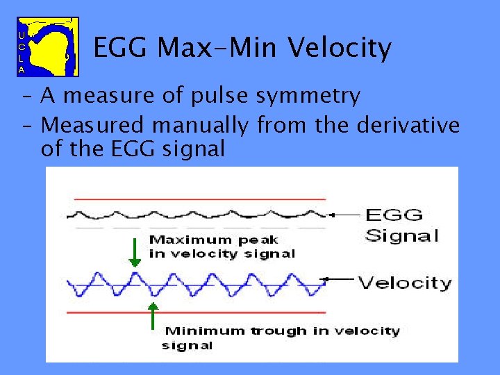 EGG Max-Min Velocity – A measure of pulse symmetry – Measured manually from the