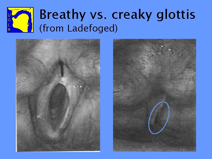 Breathy vs. creaky glottis (from Ladefoged) 