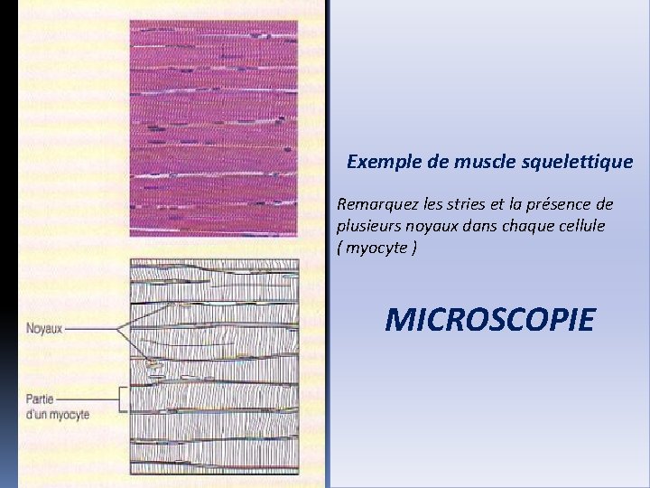 Exemple de muscle squelettique Remarquez les stries et la présence de plusieurs noyaux dans