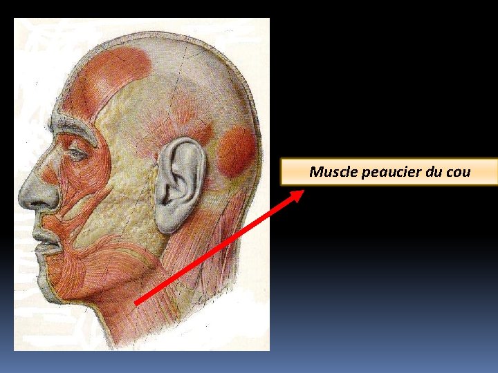 Muscle peaucier du cou 