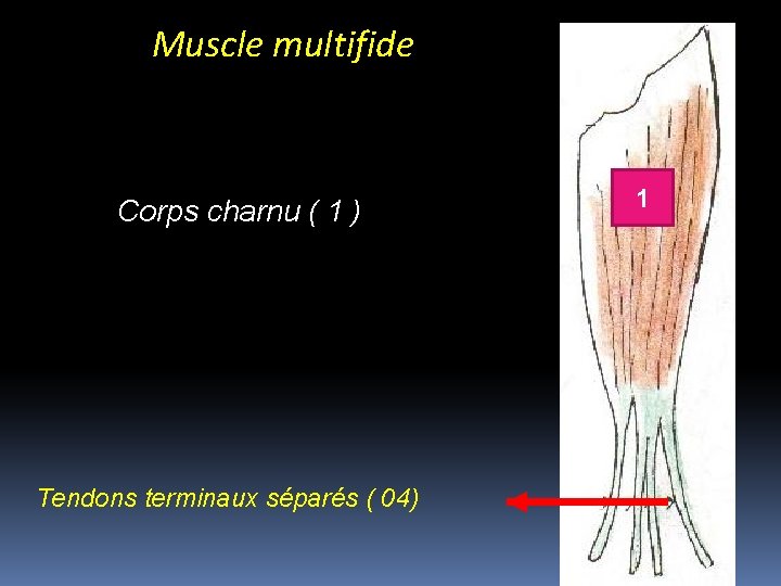 Muscle multifide Corps charnu ( 1 ) Tendons terminaux séparés ( 04) 1 