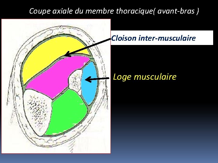 Coupe axiale du membre thoracique( avant-bras ) Cloison inter-musculaire Loge musculaire 