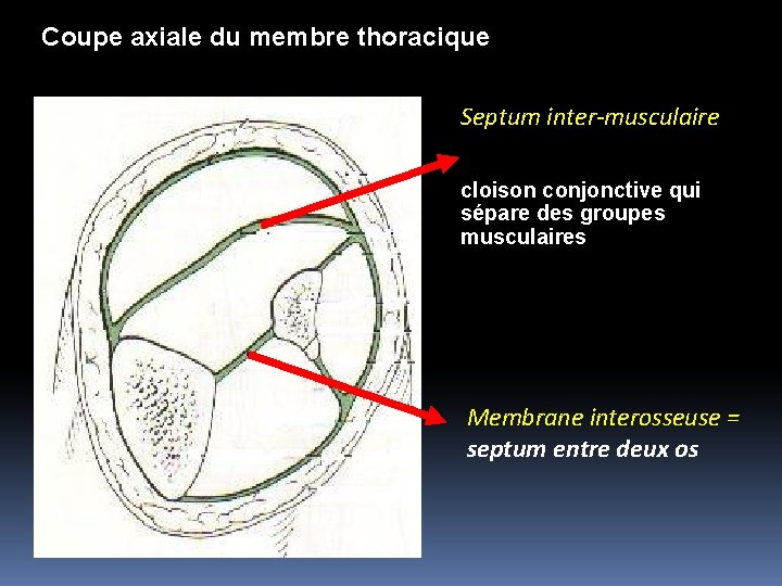 Coupe axiale du membre thoracique Septum inter-musculaire cloison conjonctive qui sépare des groupes musculaires