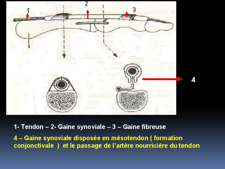 1 2 22 é 2 3 4 1 - Tendon – 2 - Gaine