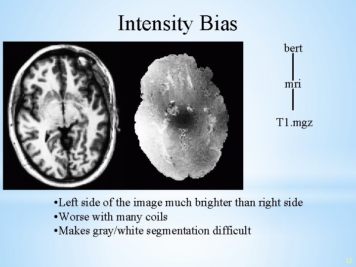 Intensity Bias bert mri T 1. mgz • Left side of the image much