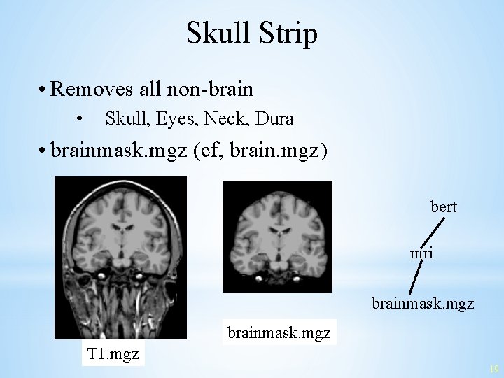 Skull Strip • Removes all non-brain • Skull, Eyes, Neck, Dura • brainmask. mgz