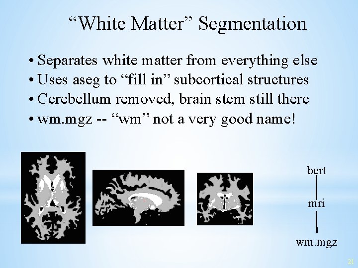“White Matter” Segmentation • Separates white matter from everything else • Uses aseg to