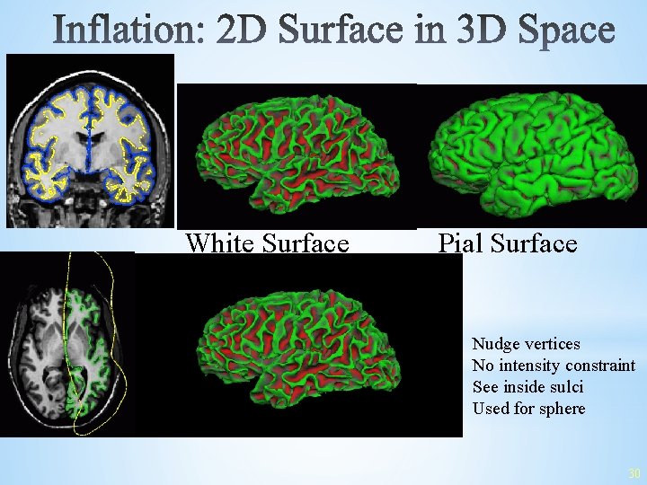 White Surface Pial Surface • • Nudge vertices No intensity constraint See inside sulci