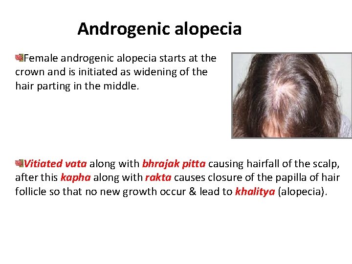 Androgenic alopecia Female androgenic alopecia starts at the crown and is initiated as widening