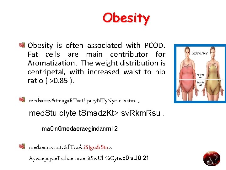 Obesity is often associated with PCOD. Fat cells are main contributor for Aromatization. The