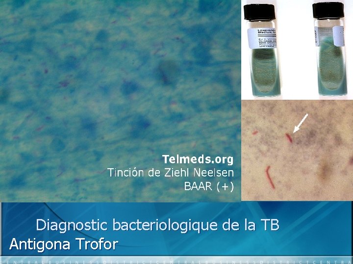 Diagnostic bacteriologique de la TB Antigona Trofor 
