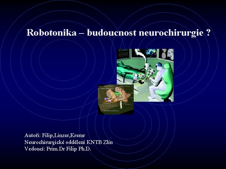 Robotonika – budoucnost neurochirurgie ? Autoři: Filip, Linzer, Kremr Neurochirurgické oddělení KNTB Zlín Vedoucí: