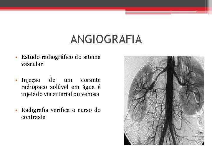 ANGIOGRAFIA • Estudo radiográfico do sitema vascular • Injeção de um corante radiopaco solúvel