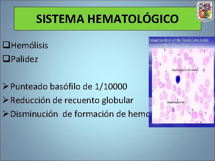 SISTEMA HEMATOLÓGICO q. Hemólisis q. Palidez Ø Punteado basófilo de 1/10000 Ø Reducción de