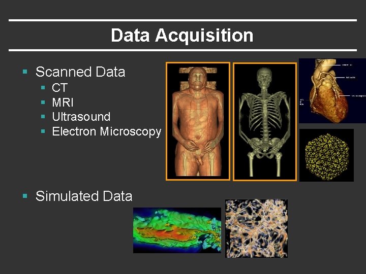 Data Acquisition § Scanned Data § § CT MRI Ultrasound Electron Microscopy § Simulated