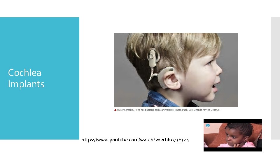 Cochlea Implants https: //www. youtube. com/watch? v=2 rh. Ro 73 F 324 