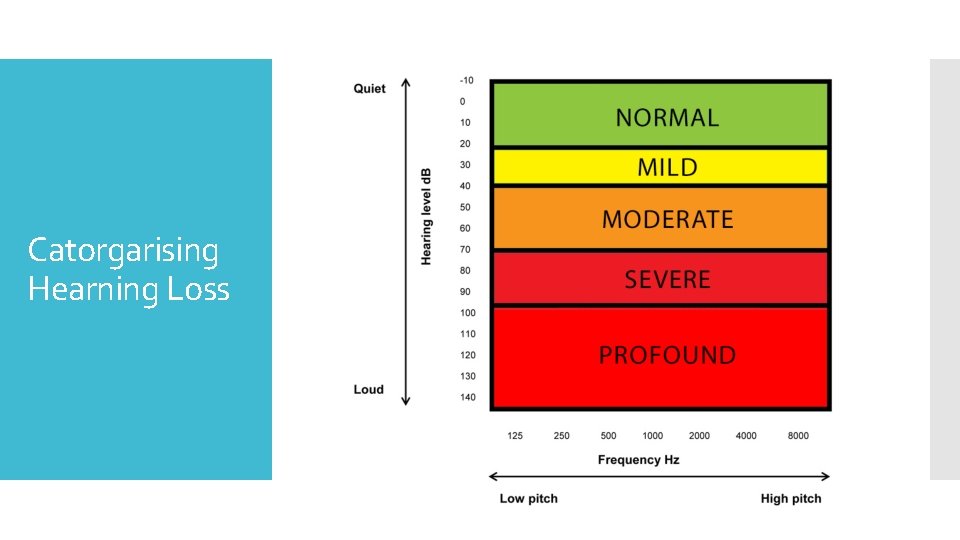 Catorgarising Hearning Loss 