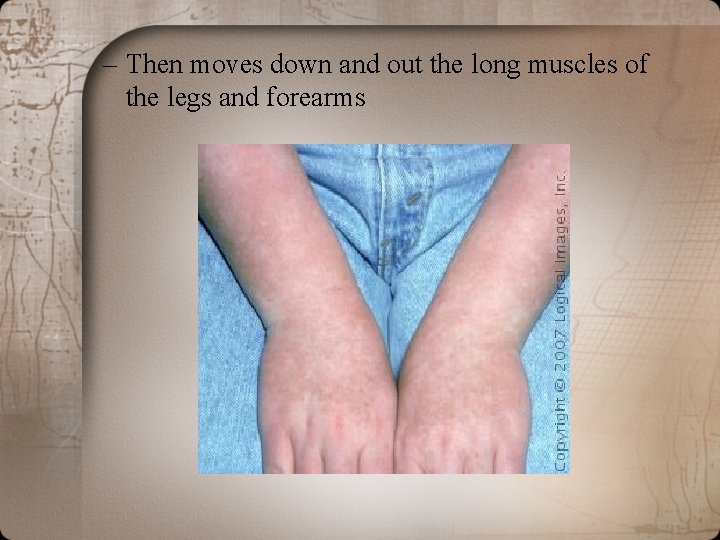 – Then moves down and out the long muscles of the legs and forearms – Then moves down and out the long muscles of the legs and forearms