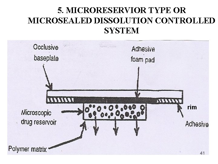5. MICRORESERVIOR TYPE OR MICROSEALED DISSOLUTION CONTROLLED SYSTEM rim 41 