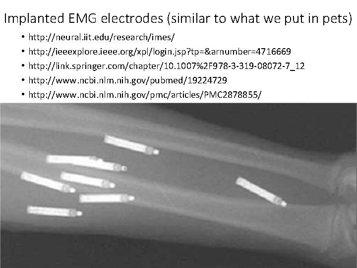 Implanted EMG electrodes (similar to what we put in pets) • • • http: