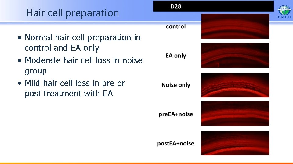 Hair cell preparation • Normal hair cell preparation in control and EA only •