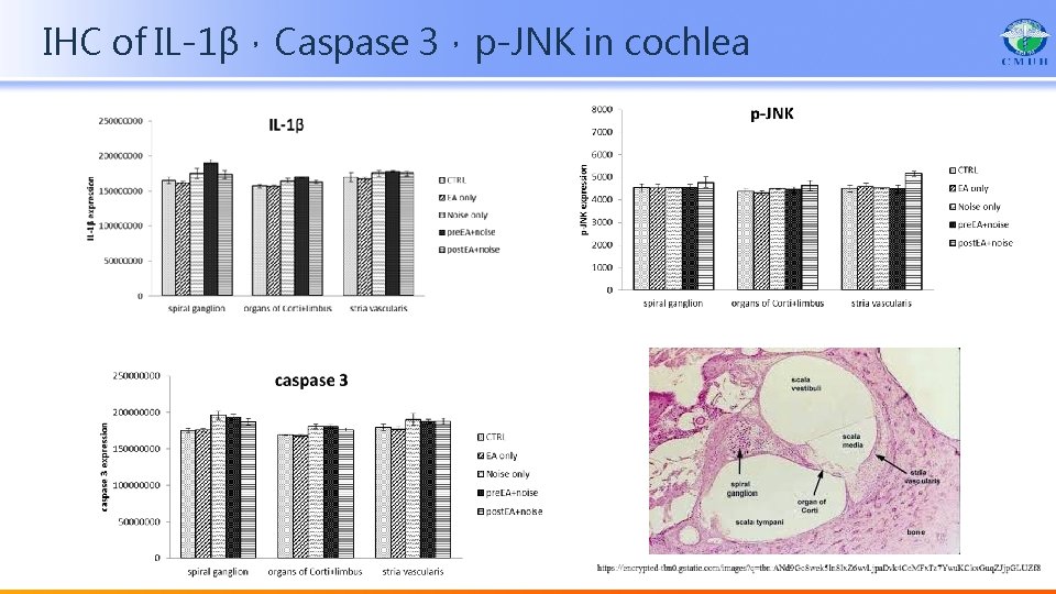 IHC of IL-1β，Caspase 3，p-JNK in cochlea 