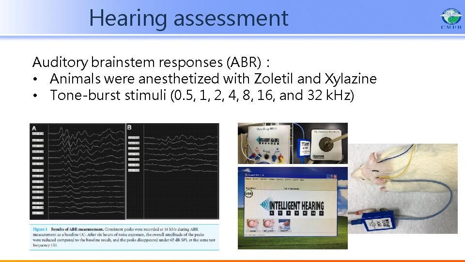 Hearing assessment Auditory brainstem responses (ABR)： • Animals were anesthetized with Zoletil and Xylazine