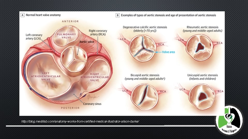 http: //blog. medillsb. com/anatomy-works-from-certified-medical-illustrator-alison-burke/ 