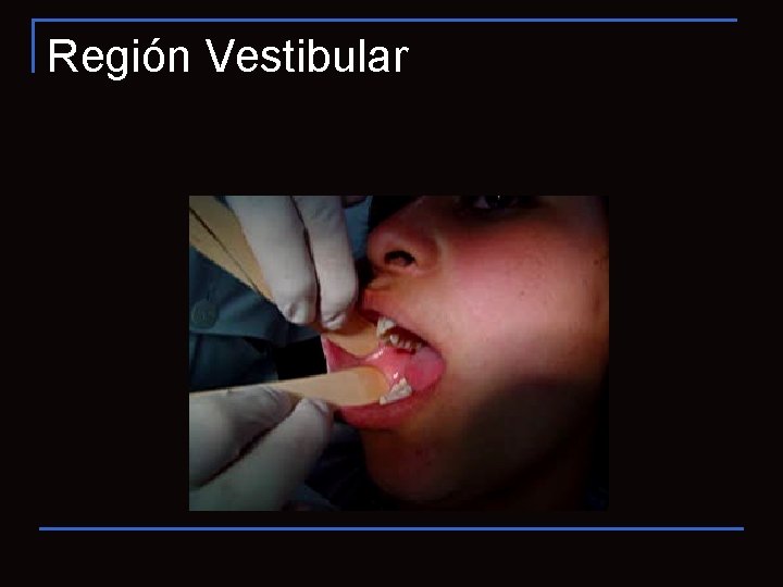 Región Vestibular 