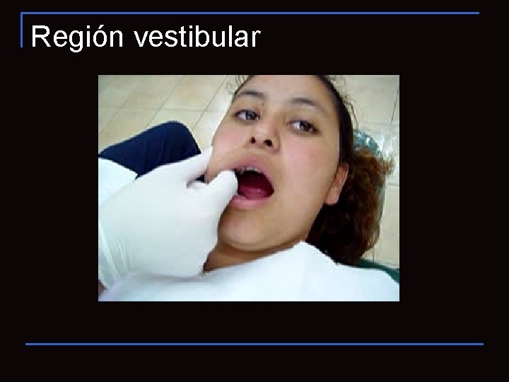 Región vestibular 