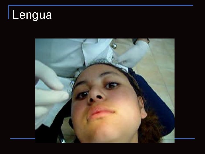 Lengua 
