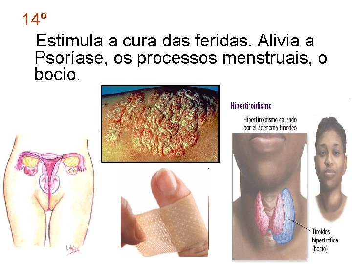 14º Estimula a cura das feridas. Alivia a Psoríase, os processos menstruais, o bocio.