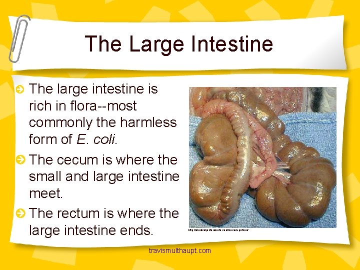 The Large Intestine The large intestine is rich in flora--most commonly the harmless form