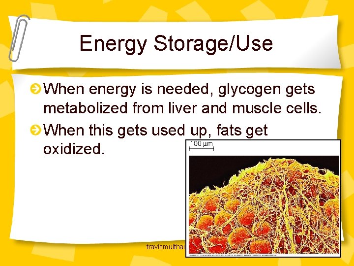 Energy Storage/Use When energy is needed, glycogen gets metabolized from liver and muscle cells.