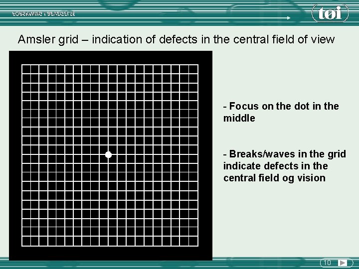 Amsler grid – indication of defects in the central field of view - Focus