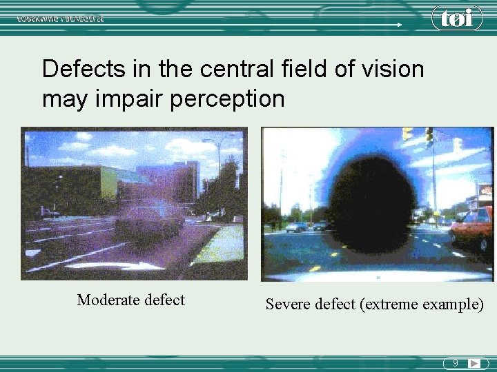 Defects in the central field of vision may impair perception Moderate defect Severe defect