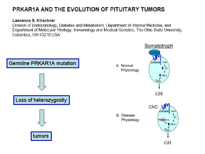 Germline PRKAR 1 A mutation Loss of heterozygosity tumors 