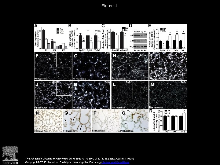 Figure 1 The American Journal of Pathology 2016 186777 -793 DOI: (10. 1016/j. ajpath.