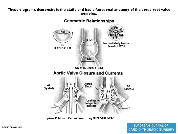 These diagrams demonstrate the static and basic functional anatomy of the aortic root valve