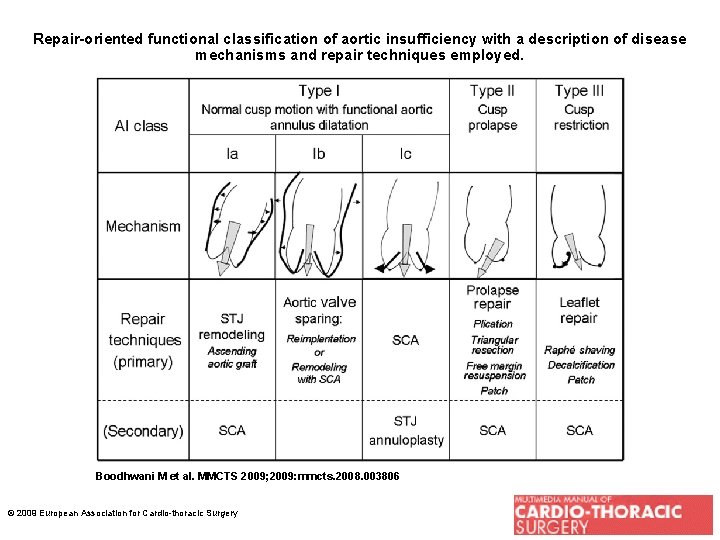 Repair-oriented functional classification of aortic insufficiency with a description of disease mechanisms and repair
