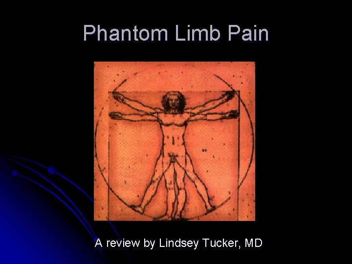 Phantom Limb Pain A review by Lindsey Tucker, MD 